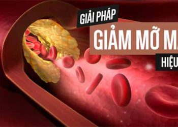 mỡ máu nguy hiểm tới sức khỏe