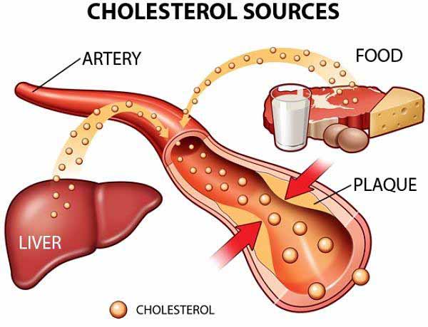 Cholesterol trong máu 