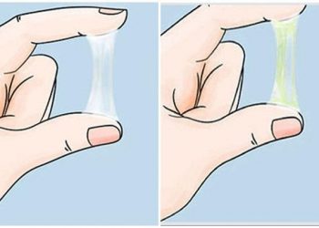 Phân biệt khí hư và huyết trắng khác nhau như thế nào?