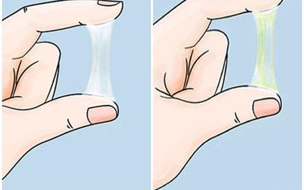 Phân biệt khí hư và huyết trắng khác nhau như thế nào?