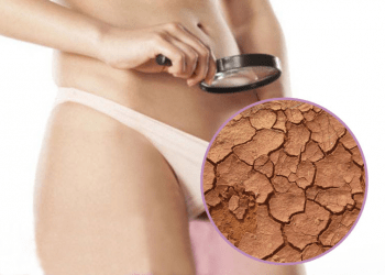 Vùng kín khô hạn sau sinh – biểu hiện và các phương pháp điều trị