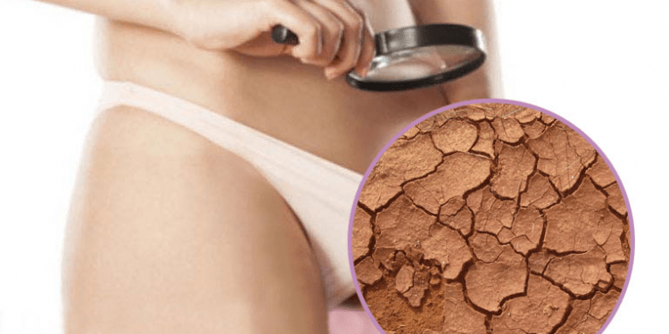 Vùng kín khô hạn sau sinh – biểu hiện và các phương pháp điều trị