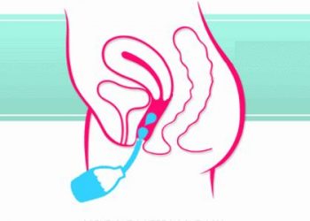 Thụt rửa vùng kín – phụ nữ thông thái nhất định phải biết những điều này!