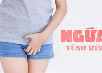Cách trị ngứa vùng kín bằng dầu dừa chị em nên biết