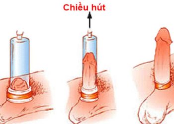 Rối loạn cương dương và cách khắc phục hiệu quả